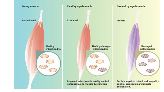 Esquema donde se muestra la relación entre diferentes niveles de expresión de Mitofusina 2 y envejecimiento muscular  (D. Sebastián, IRB Barcelona, CIBERDEM).