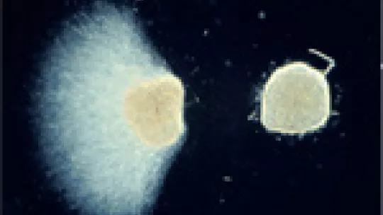 The image shows axon repulsion by semaphorin 3A. The molecule identified by researchers acts against Sema 3A.(c) E. Soriano, IRB Barcelona.