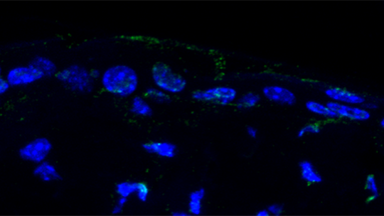 Skin stem cells from young mice (Guiomar Solanas and Francisca Peixoto, IRB Barcelona)