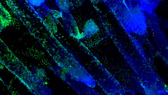 Skin stem cells. In blue, a marker of the cell nucleus. In green, a marker for the Dnmt3a protein, which is critical to ensure that cells retain stem cell features (Lorenzo Rinaldi, IRB Barcelona)