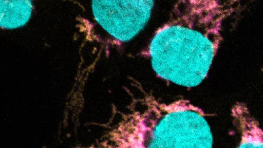 La microscopía confocal muestra la co-localización de EXD2 (magenta) con el ribosoma mitocondrial (amarillo). El ADN se tiñe para definir el núcleo (cian).