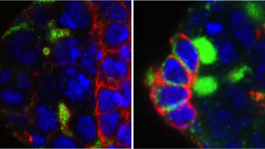  Microscopía de las células madre germinales (verde) del ovario de Drosophila de las moscas que carecen de EXD2. Las moscas en el panel derecho fueron tratadas con antioxidantes para rescatar las células madre. Imagen: Travis Stracker, IRB Barcelona 