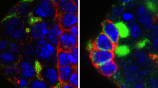  Microscopía de las células madre germinales (verde) del ovario de Drosophila de las moscas que carecen de EXD2. Las moscas en el panel derecho fueron tratadas con antioxidantes para rescatar las células madre. Imagen: Travis Stracker, IRB Barcelona 