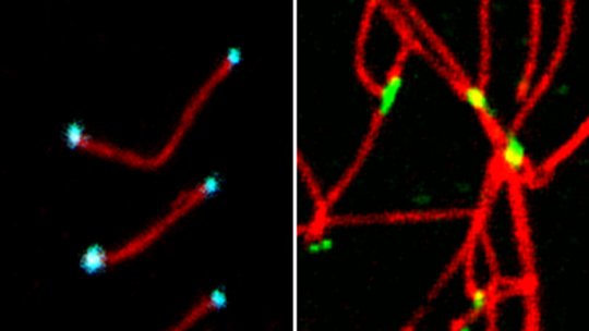 Sin RingoA, los telómeros (verde) -extremos de los cromosomas - se fusionan entre ellos lo que produce fallos en meiosis y muerte celular. Con la proteína en telómeros (azul), los cromosomas se mantienen separados. (P.Mikolcevic)