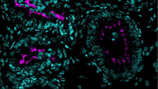 Corte transversal de conductos eferentes sanos fotografiada con un microscopio fluorescente