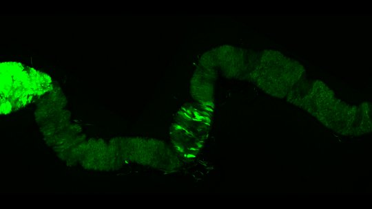 In green, tumour growth in the intestine of an adult fly (O Martorell, IRB Barcelona)