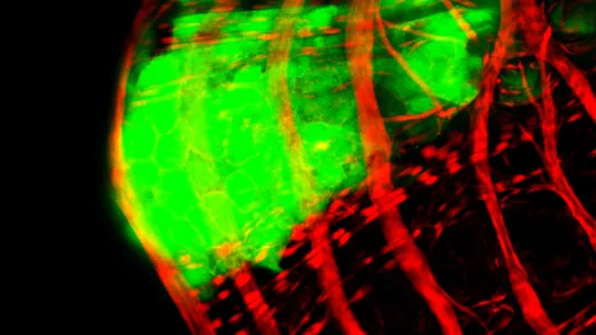 In green, details of a tumour surrounded by the muscle fibres (red) of the Drosophila (O Martorell, IRB Barcelona)