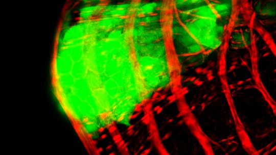 En verd, detall d’un tumor envoltat per fibres musculars de l'intestí de Drosophila, en vermell (O Martorell, IRB Barcelona)