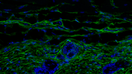 Skin of a young mouse. The image shows a cross section of the skin with the fibroblasts indicated in green. The thickness of the dermis and the density of fibroblasts is much greater in young skin than in aged skin– cell nuclei, in blue (M Salzer, IRB Bar