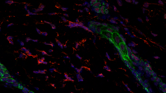 Imatge de microscòpia confocal de la barrera de la pell (en verd), fol·licle pilós (en verd) i els fibroblasts (en vermell) -en blau, els nuclis cel·lulars (Marion Salzer, IRB Barcelona)