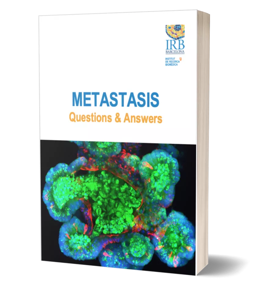Download Metastasis: Questions and Answers eBook
