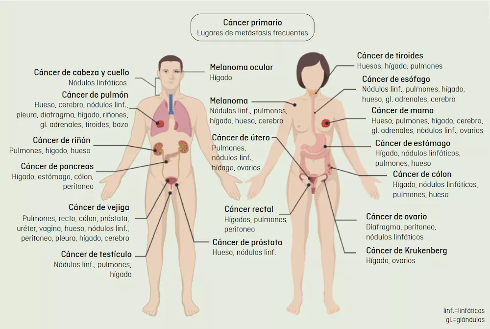 Imagen con los órganos vitales habitualmente afectados por metástasis según el lugar del tumor inicial, desglosado por cuerpo masculino y femenino
